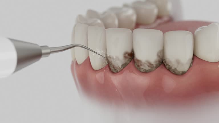 Reliable Tooth Extraction contractor in Patterson, CA by Smile Center Dentistry